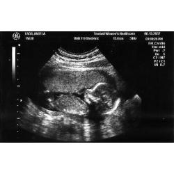 16 Weeks Pregnant. Symptoms, Fetus Ultrasound, Belly ...