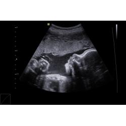 29 Weeks Pregnant: Symptoms, Fetus Ultrasound, Belly Photos