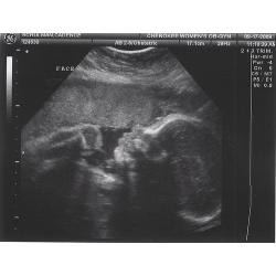 29 Weeks Pregnant: Symptoms, Fetus Ultrasound, Belly Photos